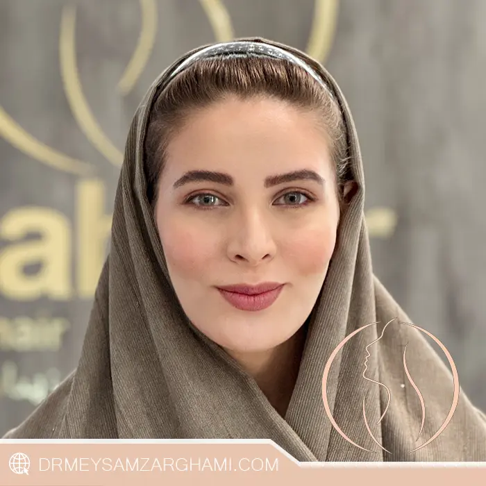 Benefits of stem cell exosomes in biofat fat injections